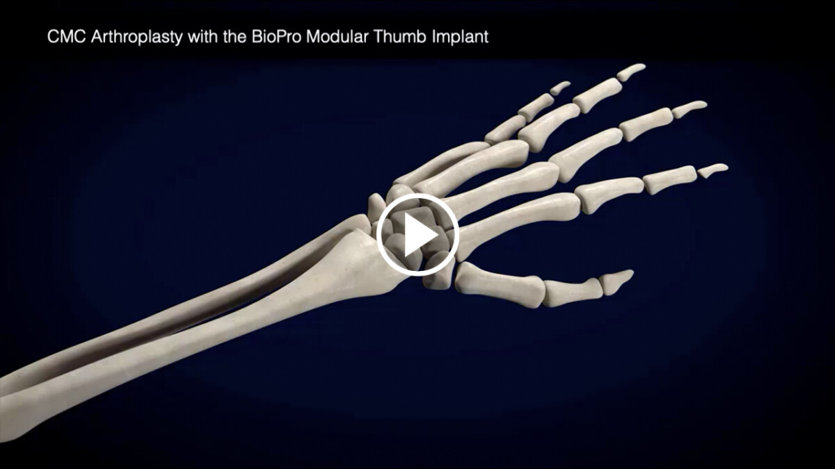 Procedure Videos - bioproimplants.com